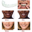 Upper & Lower Teeth Veneers - Simulation Braces Snap On Smile Tooth Cover - Perfect Teeth Whitening Replacement No Pain No Shots No Drilling Fix Smile in Minutes 2 PACK