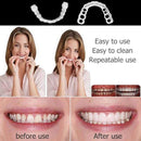 Upper & Lower Teeth Veneers - Simulation Braces Snap On Smile Tooth Cover - Perfect Teeth Whitening Replacement No Pain No Shots No Drilling Fix Smile in Minutes 2 PACK